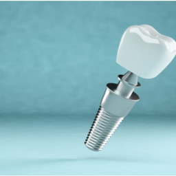 FexDental. Aditamentos dentales compatibles, FexDental. Aditamentos Dentales Compatibles.